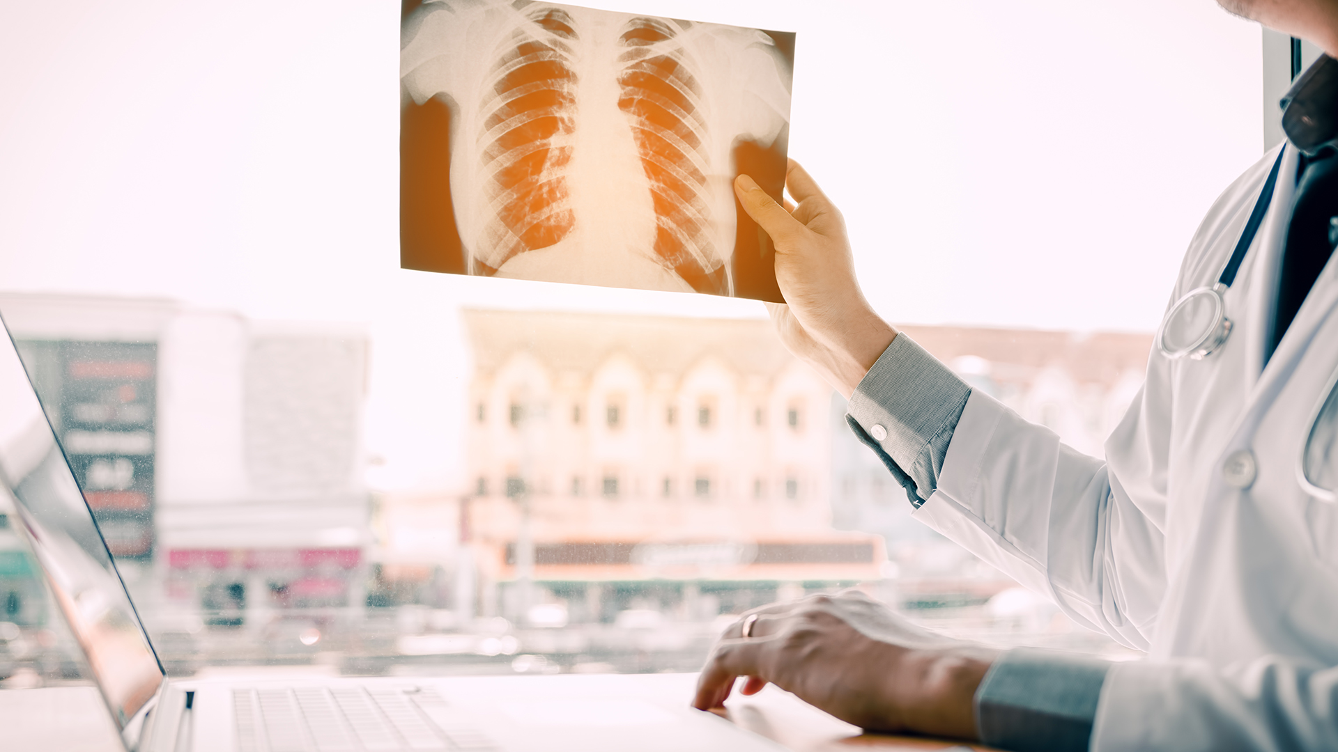 Tras la infección por el coronavirus, se encontró que los participantes del estudio en EE.UU. tenían riesgos elevados de problemas pulmonares, cardíacos, sanguíneos, entre otros problemas/Archivo