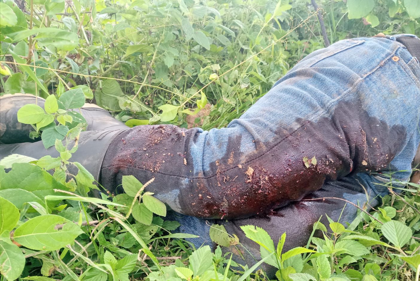El supuesto miembro del CJNG quedó herido en las piernas (Foto: Ejército de Guatemala)