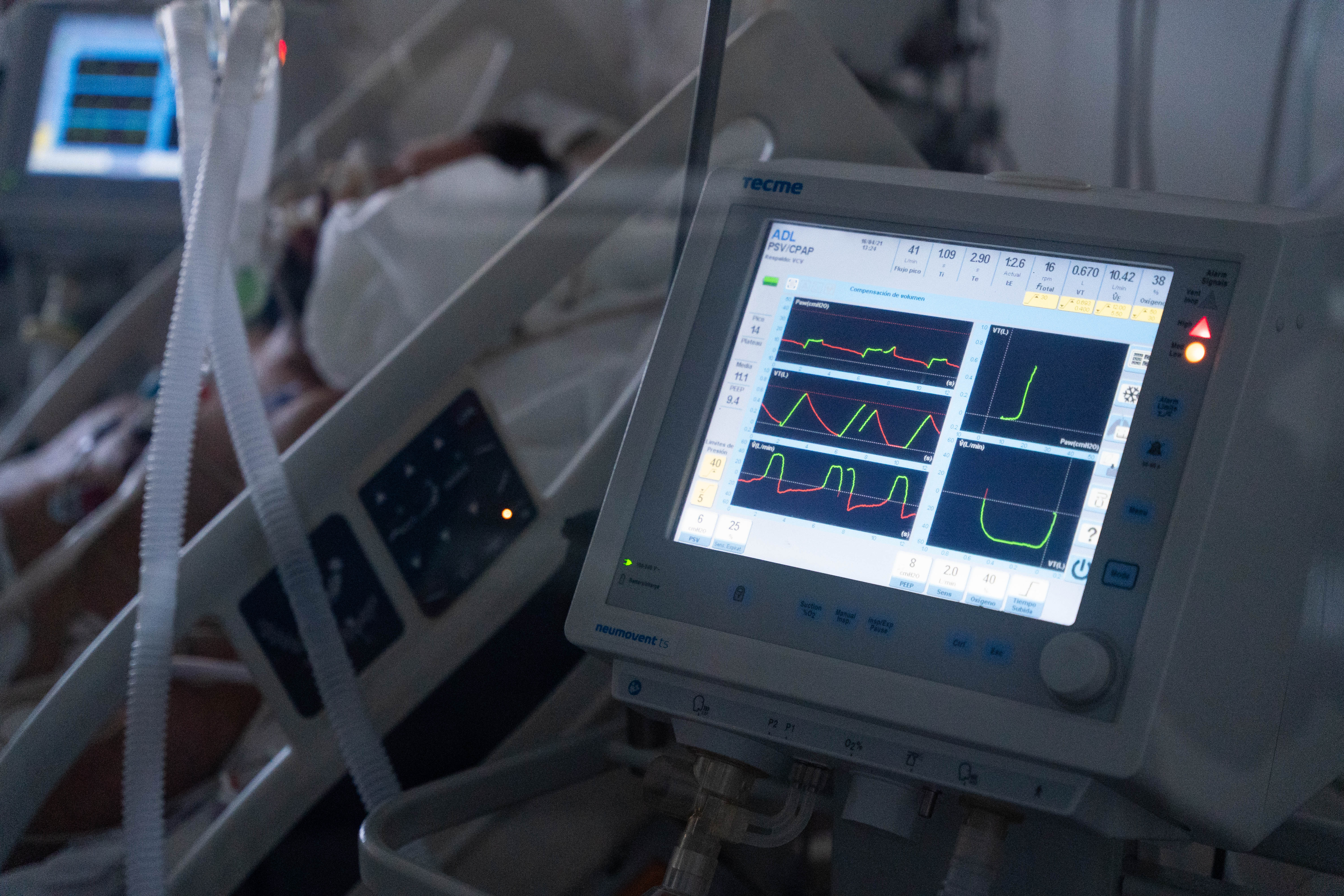 Los pacientes con COVID-19 que requieren respirador en unidades de terapia intensiva son monitoreados segundo a segundo con tecnologías sofisticadas y el cuidado de un equipo de profesionales especializados (Foto: Franco Fafasuli)