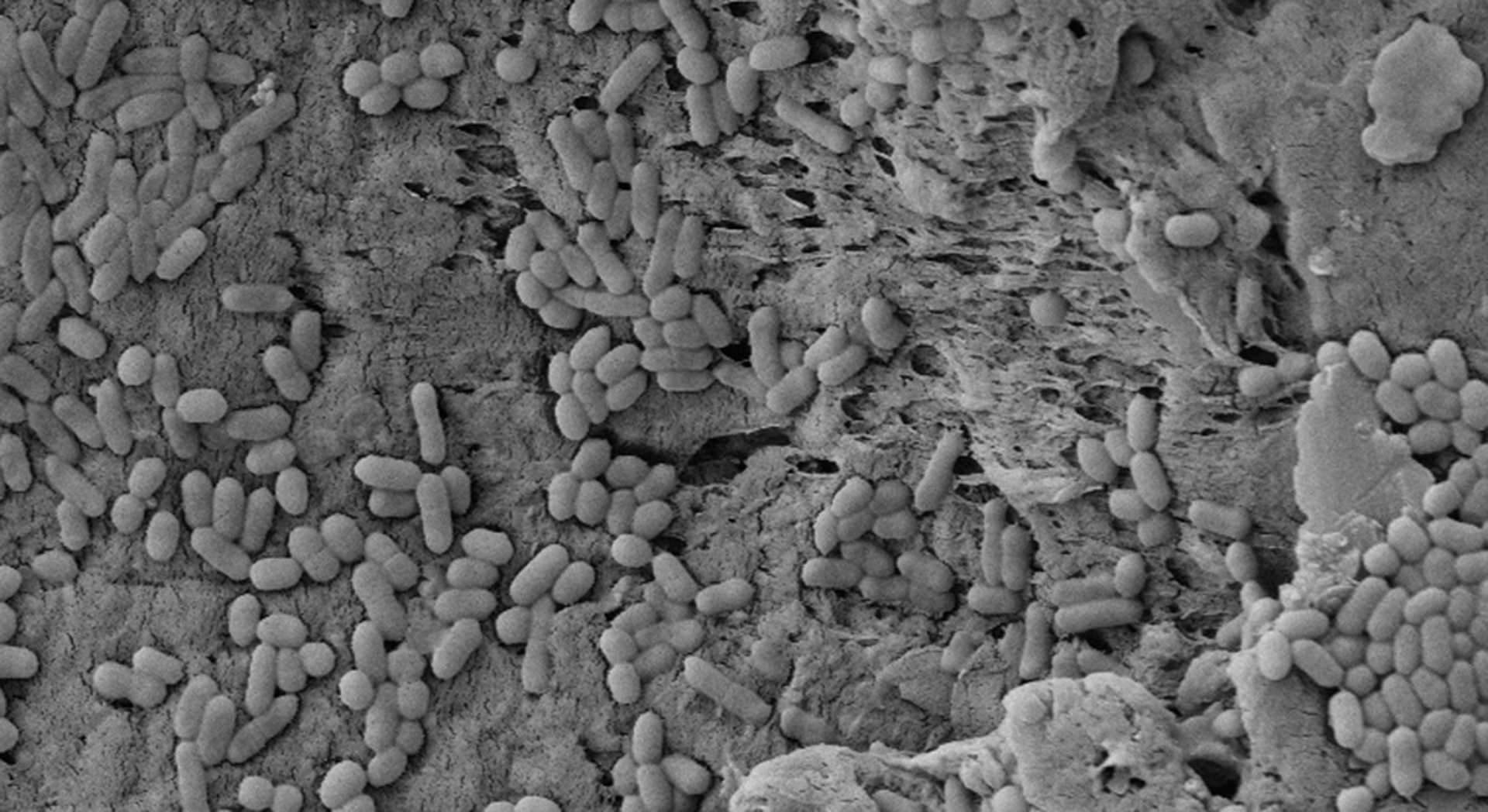 Microscopia electronica del biofilm de Listeria monocytogenes, la bacteria que causaría la enfermedad  (Archivo)