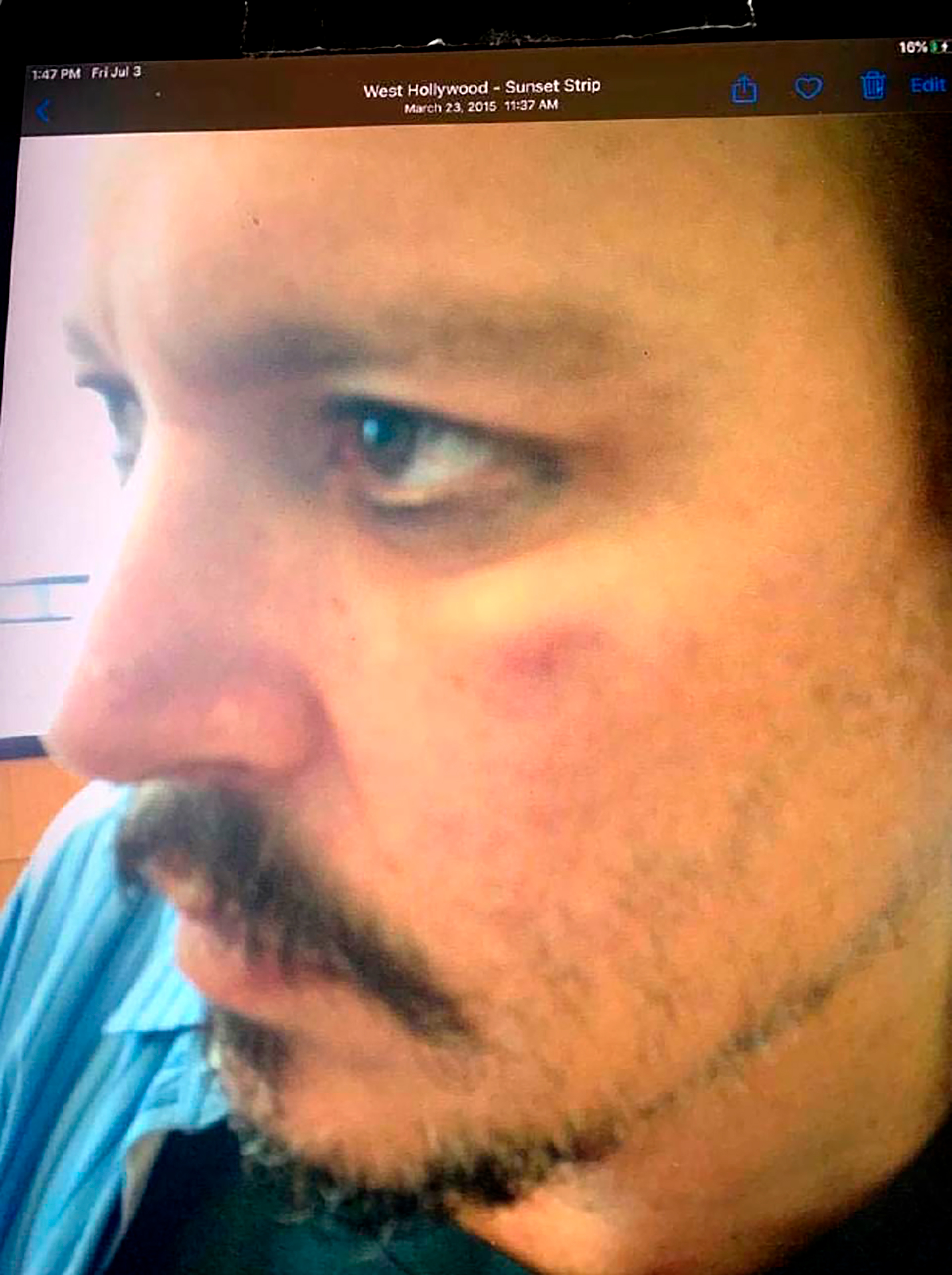 El guardia de seguridad de Johnny Depp, Sean Bett, mostró fotografías del actor con un ojo morado después de que su entonces esposa, Amber Heard, supuestamente lo golpeó. Dijo que fue tomada en abril de 2016, pero la defensa de The Sun afirma de que en realidad fueron tomadas en marzo de 2015