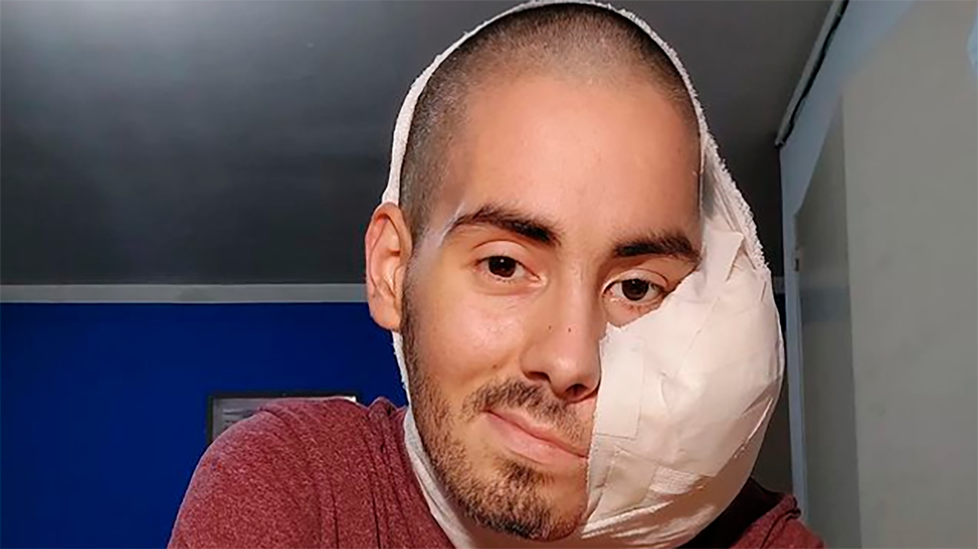 彼はもう苦しんでいない」：顔に腫瘍があった25歳のセバスチャン