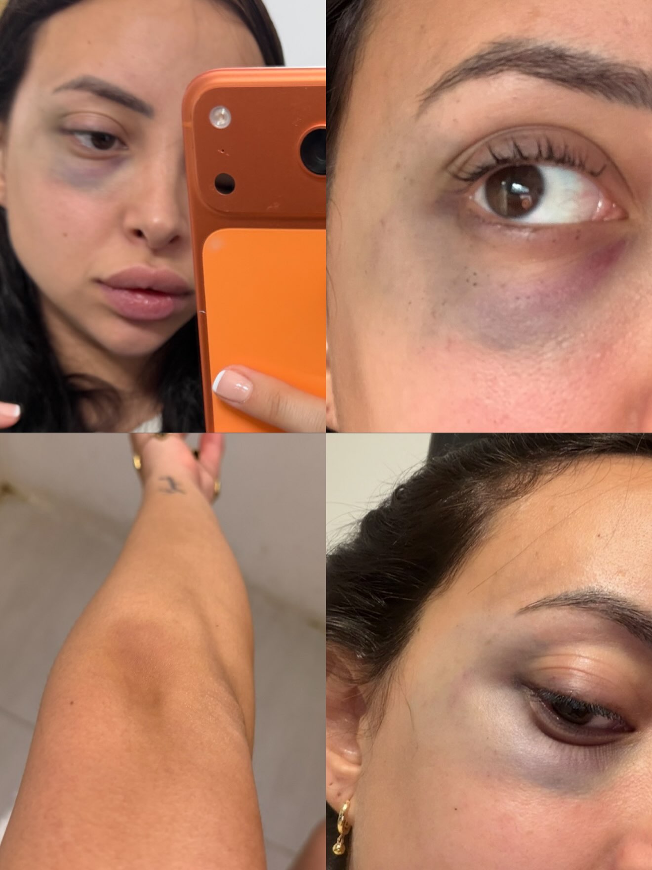 La novia de un ex futbolista de Boca lo acusó por violencia de género