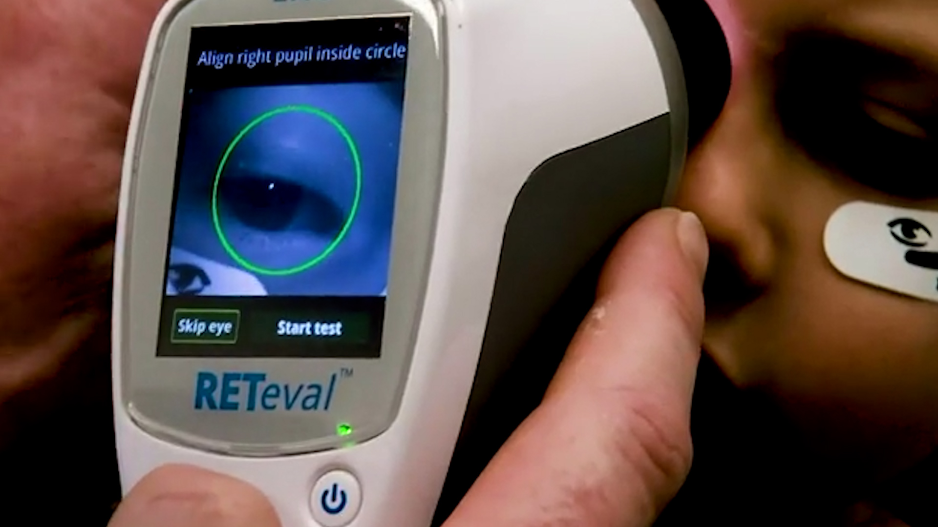 Un Test De Retina Con Una Cámara De Alta Resolución Permitiría Detectar Trastornos Del Espectro 6662