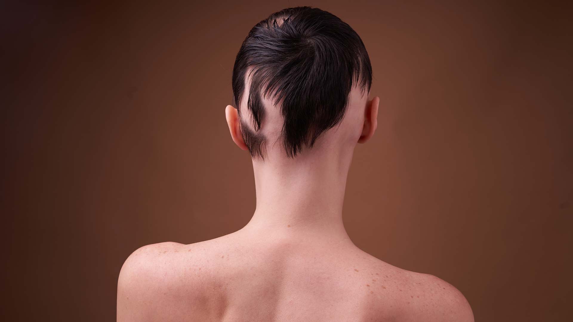 La alopecia se ve cada vez más en personas de menor edad (Getty)