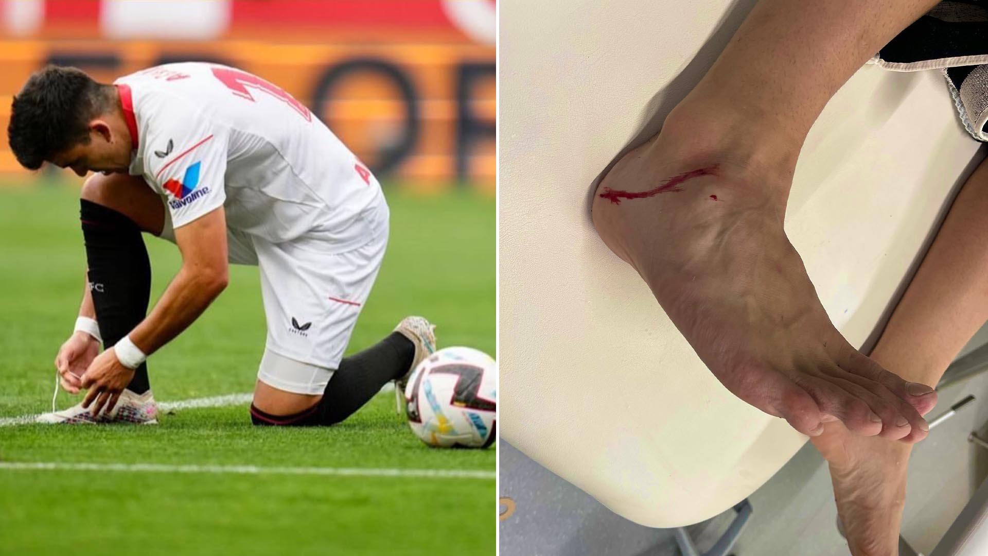 La brutal patada que desencadenó un tenso cruce entre Huevo Acuña y un jugador del Real Madrid