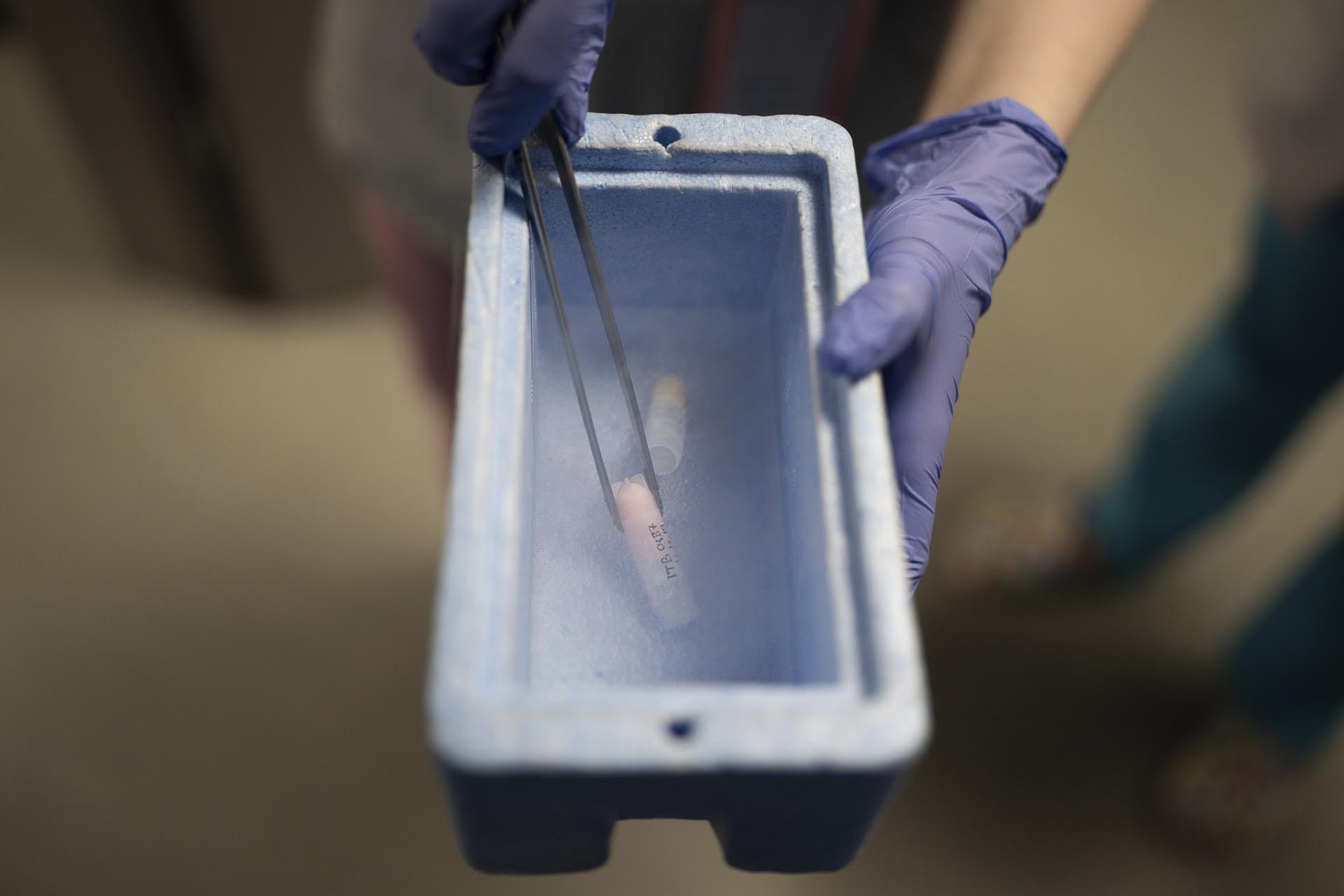 Un médico muestra una muestra de esperma en un tubo almacenado en nitrógeno líquido en la clínica de fertilidad IVMED en Kiev. (Foto AP/Roman Hrytsyna)
