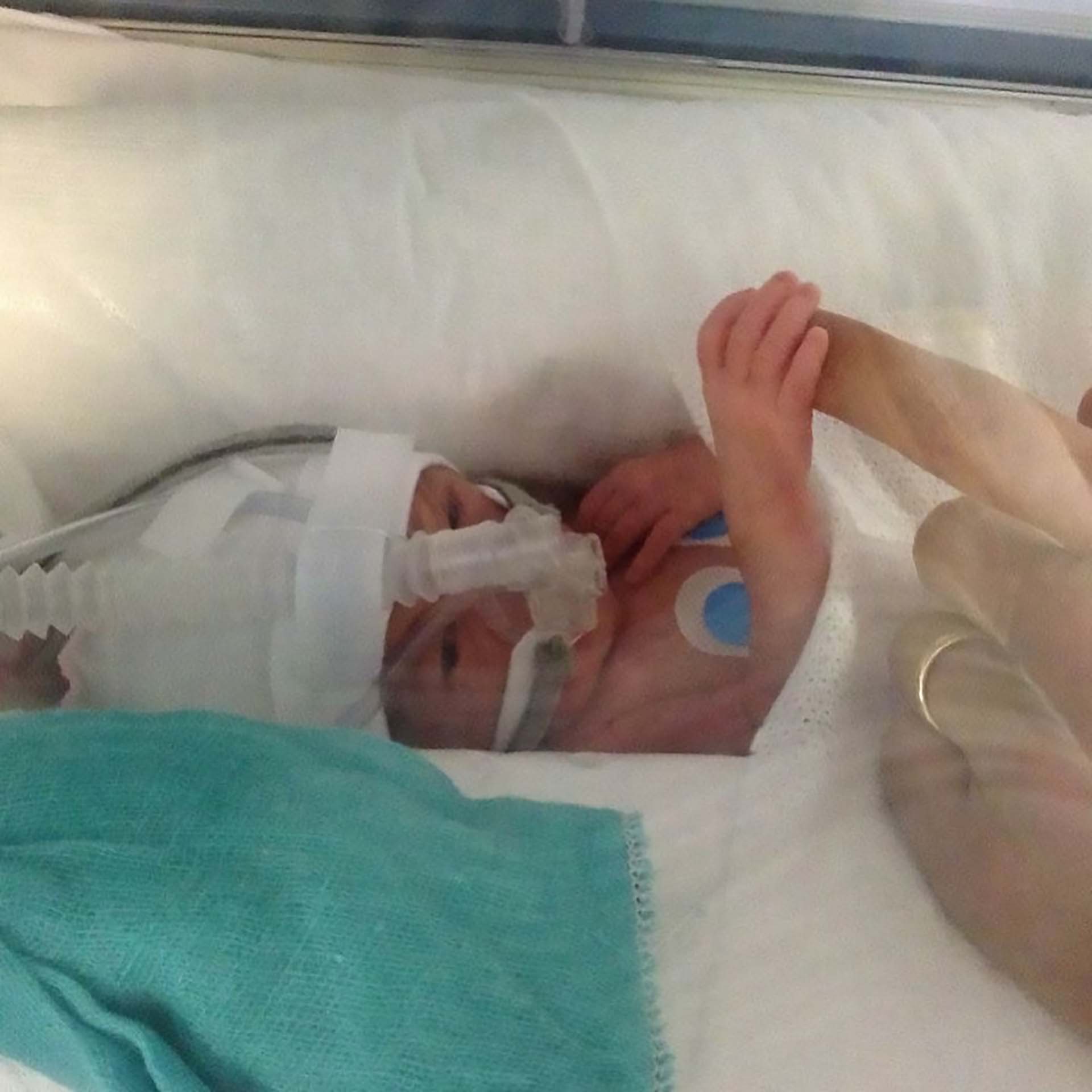 Sobrevivió, además, a una infección grave (Instagram Jorgelina Cardoso)