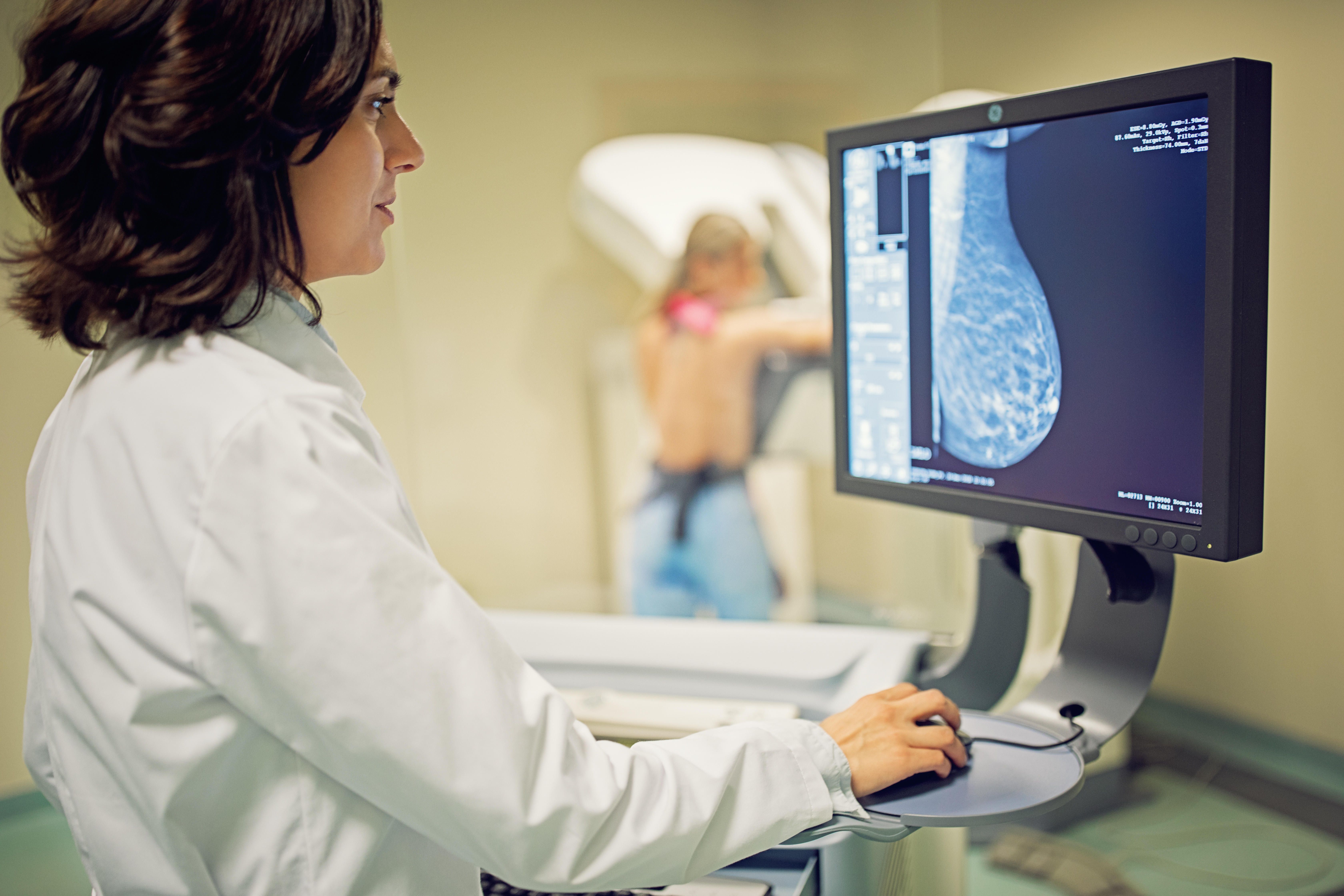 Según el informe de la OCDE de 2022, Primary Health Care for Resilient Health Systems in Latin America, el método (mamografía) y la periodicidad (cada dos años) siguen las recomendaciones de la OMS