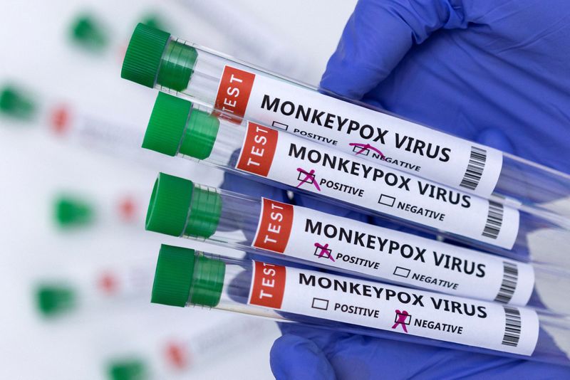Tubos de ensayo etiquetados como "virus de la viruela del mono positivo y negativo" en una ilustración tomada el 23 de mayo de 2022. REUTERS/Dado Ruvic