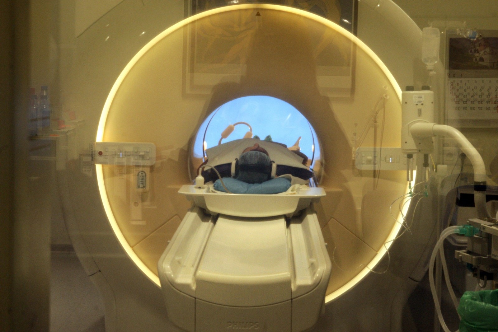 Los tratamientos los investigadores dirigidos por Chan están utilizando resonancias magnéticas para comprender las causas de los efectos de COVID en la memoria, la velocidad del pensamiento y la toma de decisiones
