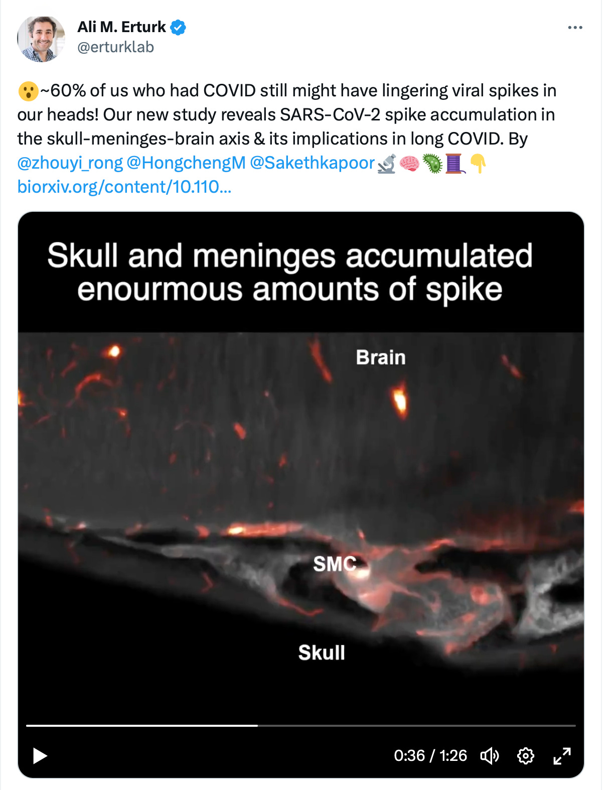 Conexión SMC cráneo-meninges que alberga la proteína de pico. Explicación en Twitter de Ali Erturk, el autor principal de este estudio 