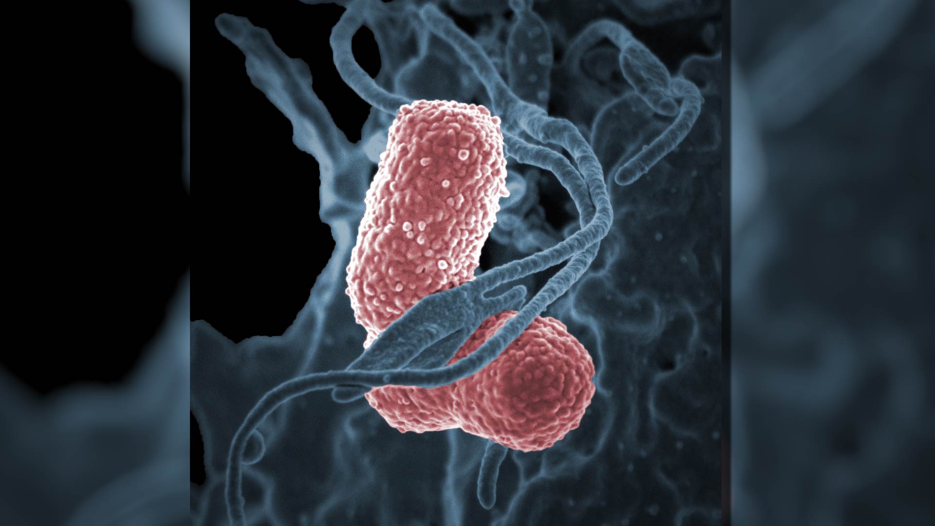 Las infecciones por la superbacteria Klebsiella suelen producirse en pacientes enfermos que reciben tratamiento para otras afecciones/Archivo