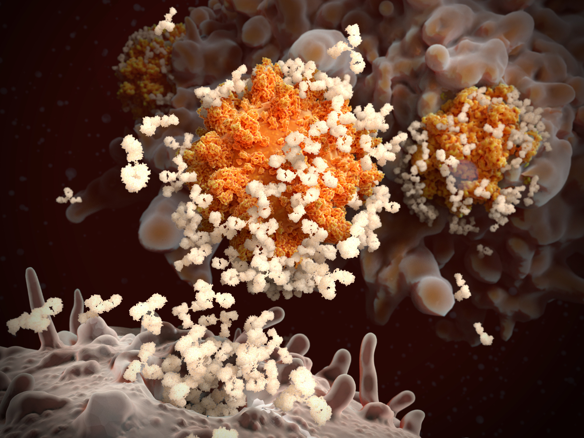 Respuesta inmune al SARS-CoV-2: los linfocitos B liberan anticuerpos que se unen y marcan los coronavirus, por lo que los virus no pueden penetrar en sus células objetivo y son engullidos y destruidos por un macrófago (célula en el fondo).
