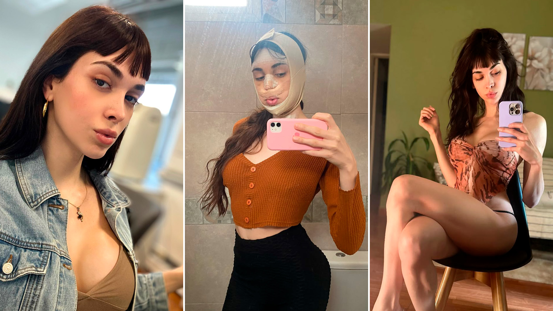 La joven trans que cuenta el lado b de la cirug&iacute;a de reasignaci&oacute;n: el costo de la intervenci&oacute;n y c&oacute;mo fue volver a tener sexo