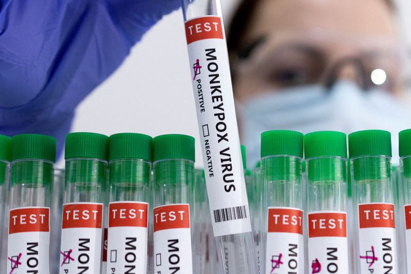 Imagen de ilustración de tubos de ensayo con la etiqueta "Virus de la viruela del mono positivo" (Foto: Reuters)