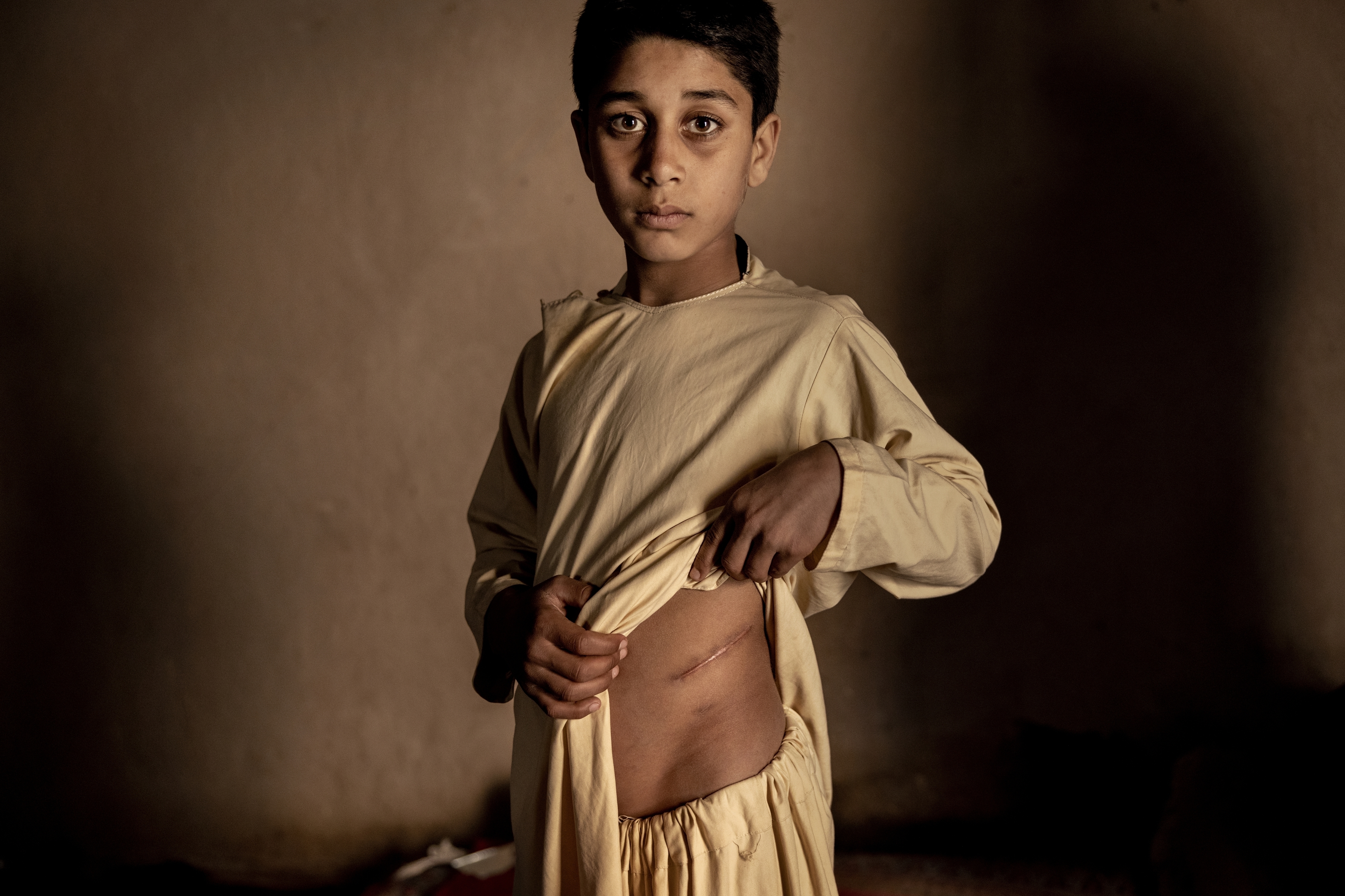 Foto de la serie titulada "El precio de la paz en Afganistán", que ganó la categoría Mejor Reportaje Fotográfico, del fotógrafo Mads Nissen (Politiken/Panos Pictures)