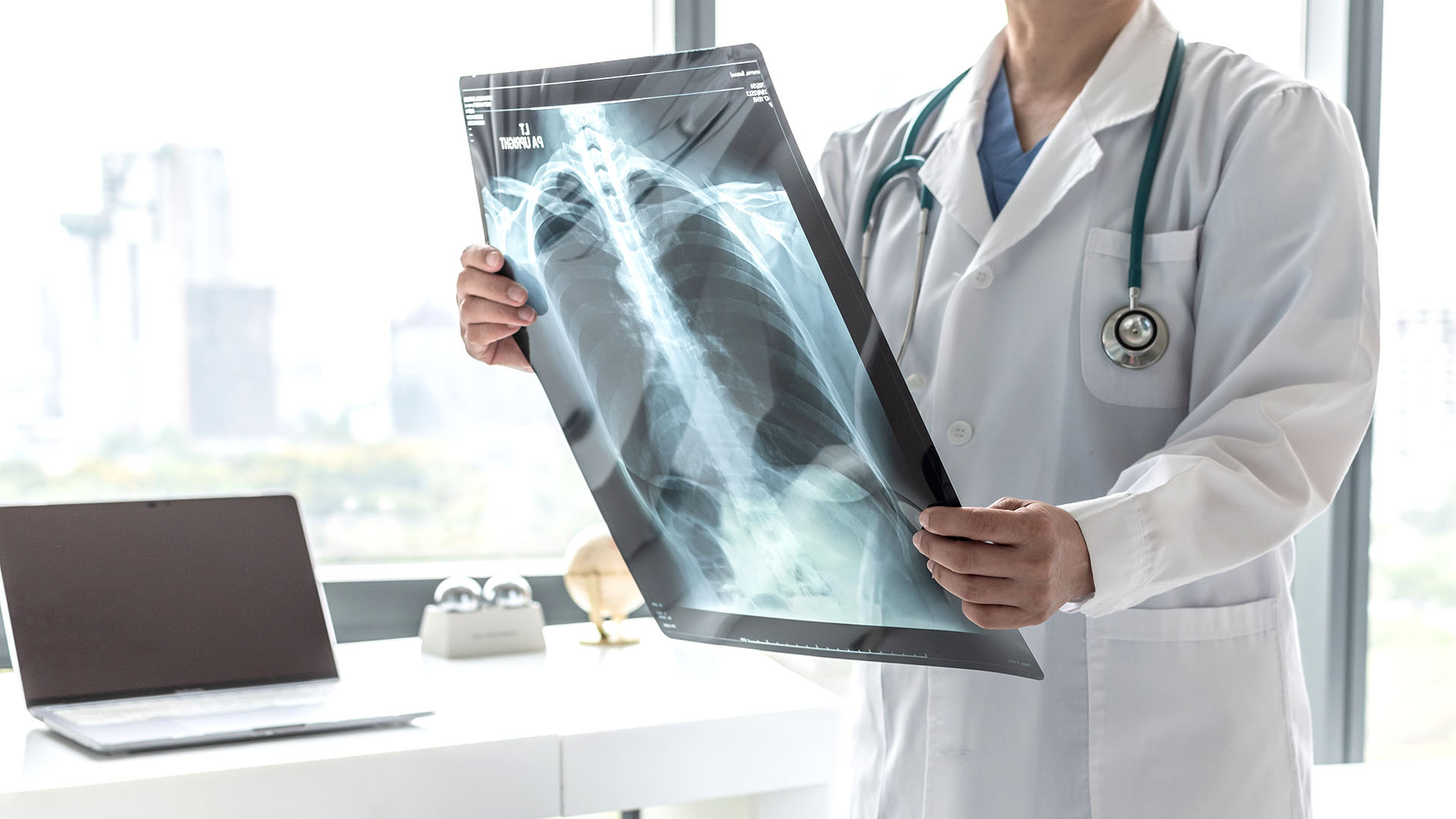La mayor sobrevida se logra en pacientes que reciben una atención interdisciplinaria en centros especializados, con un intensivo tratamiento para sostener la función pulmonar (Shutterstock)