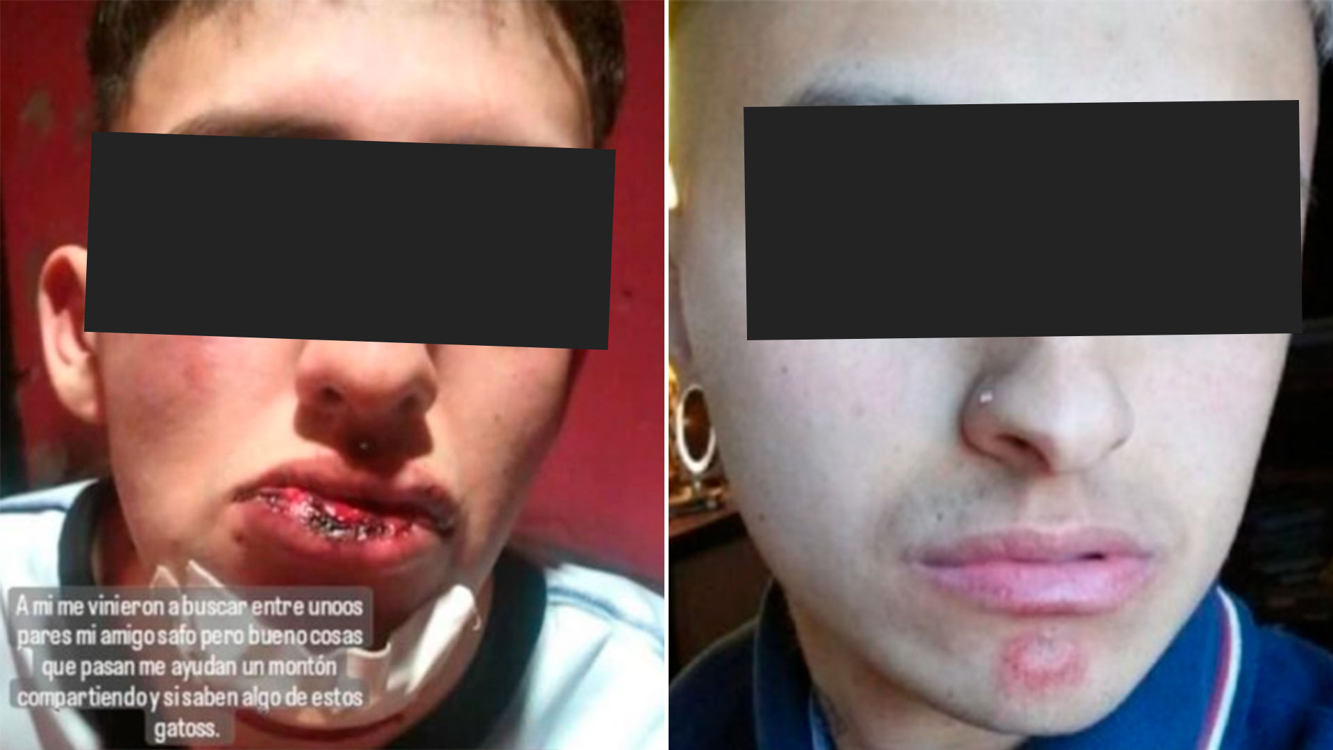 Los dos jóvenes agredidos en Ezpeleta