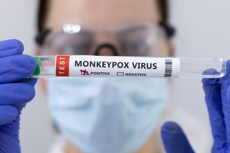 Foto de archivo ilustrativa de tubos de ensayo con una etiqueta de positivo a la viruela del mono
May 23, 2022. REUTERS/Dado Ruvic/