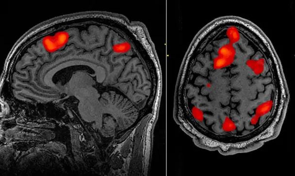 El decodificador puede reconstruir el habla utilizando datos de escaneo fMRI.