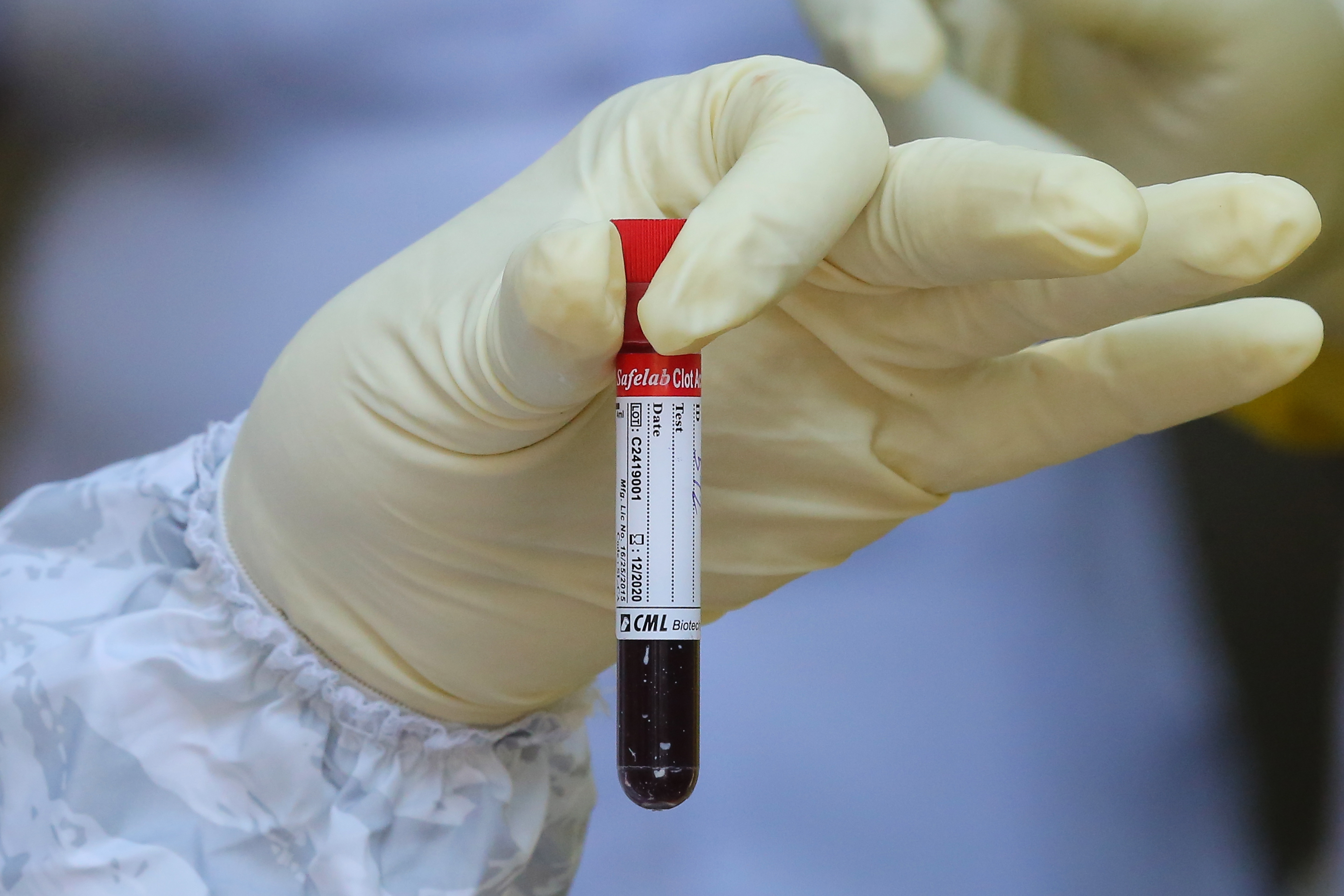 Las personas con grupo sanguíneo A podrían tener una mayor probabilidad de infectarse por COVID-19 por el comportamiento de una proteína del virus (EFE)
