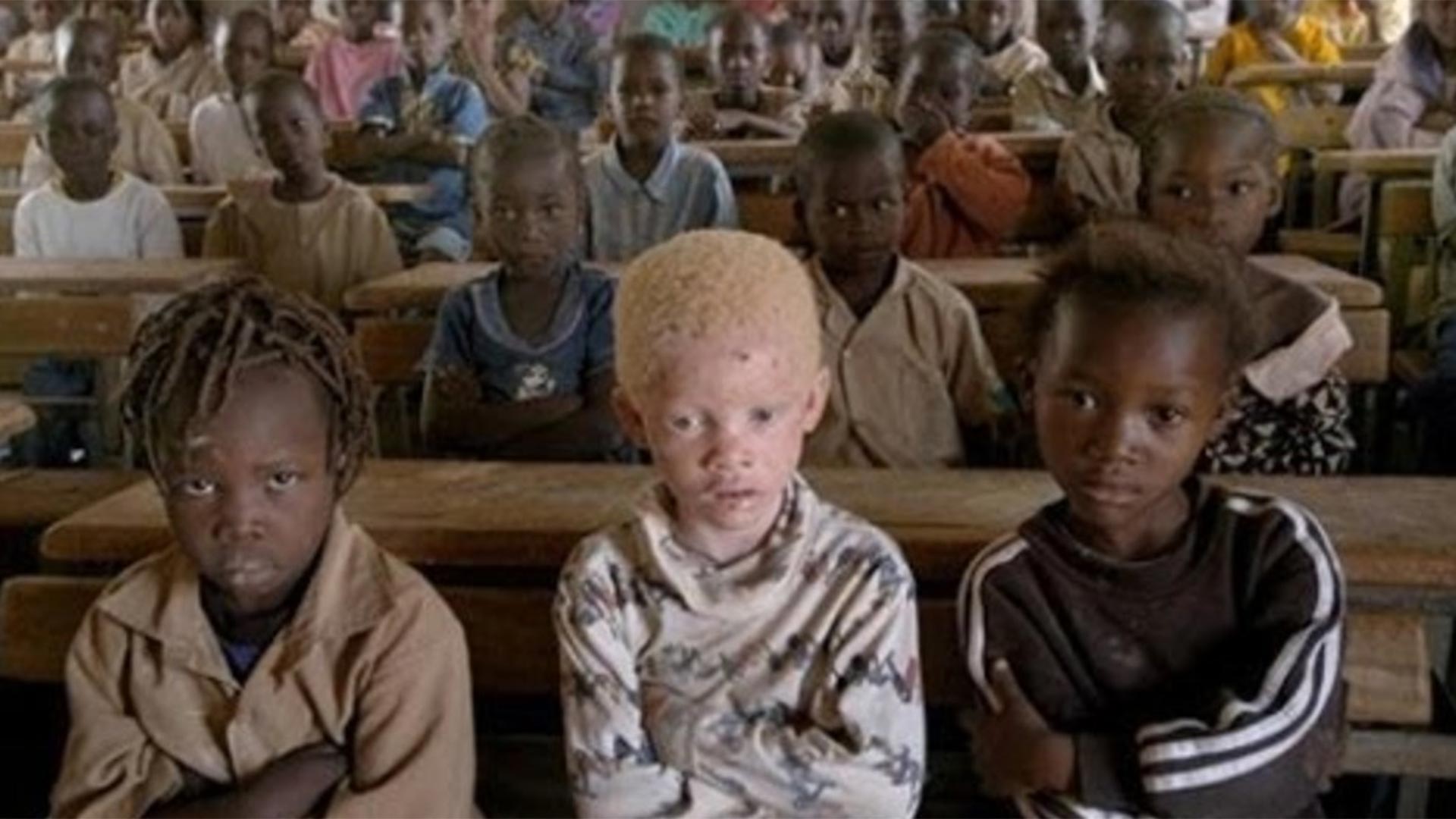 Los albinos corren riesgos en unos 25 países africanos, pero es en Malawi, Tanzania y Mozambique donde más se los ataca, secuestra, mutila y asesina (AFP)