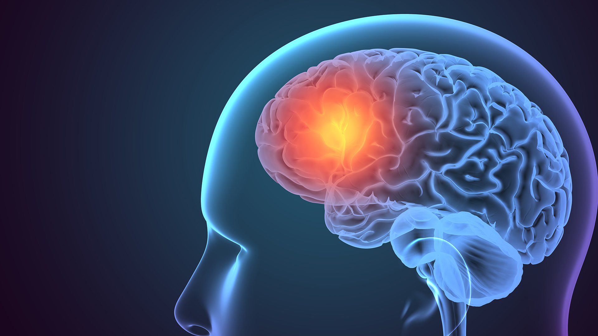 Epilepsia: el diagnóstico temprano y el acceso a los tratamientos son claves para controlar la enfermedad