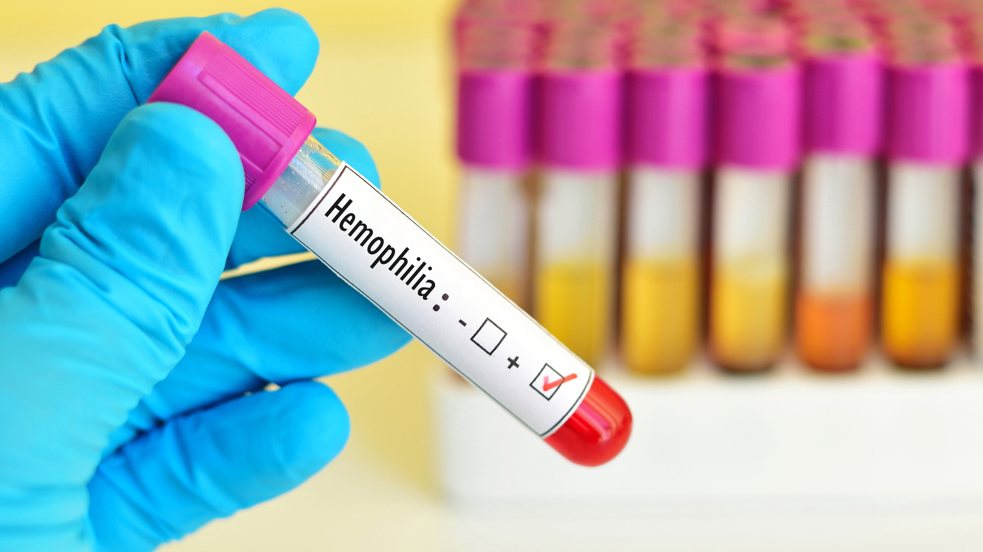 La Importancia De Adherir A Los Tratamientos Para Desarrollar Una Vida Plena Hemofilia Latam 9126