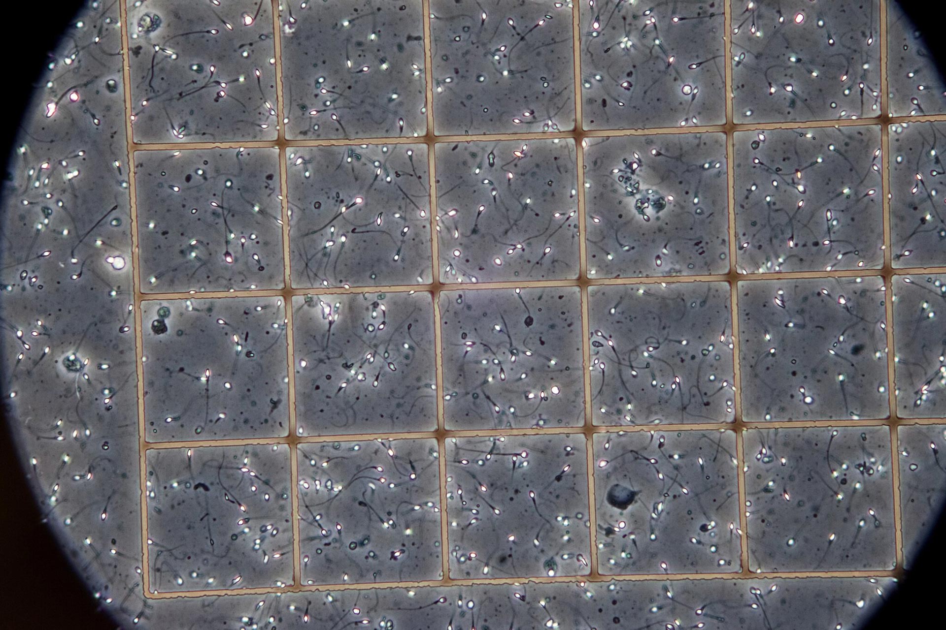 Una muestra de un banco de esperma bajo el microscopio en una instalación de Cryos en Dinamarca (NY Times)