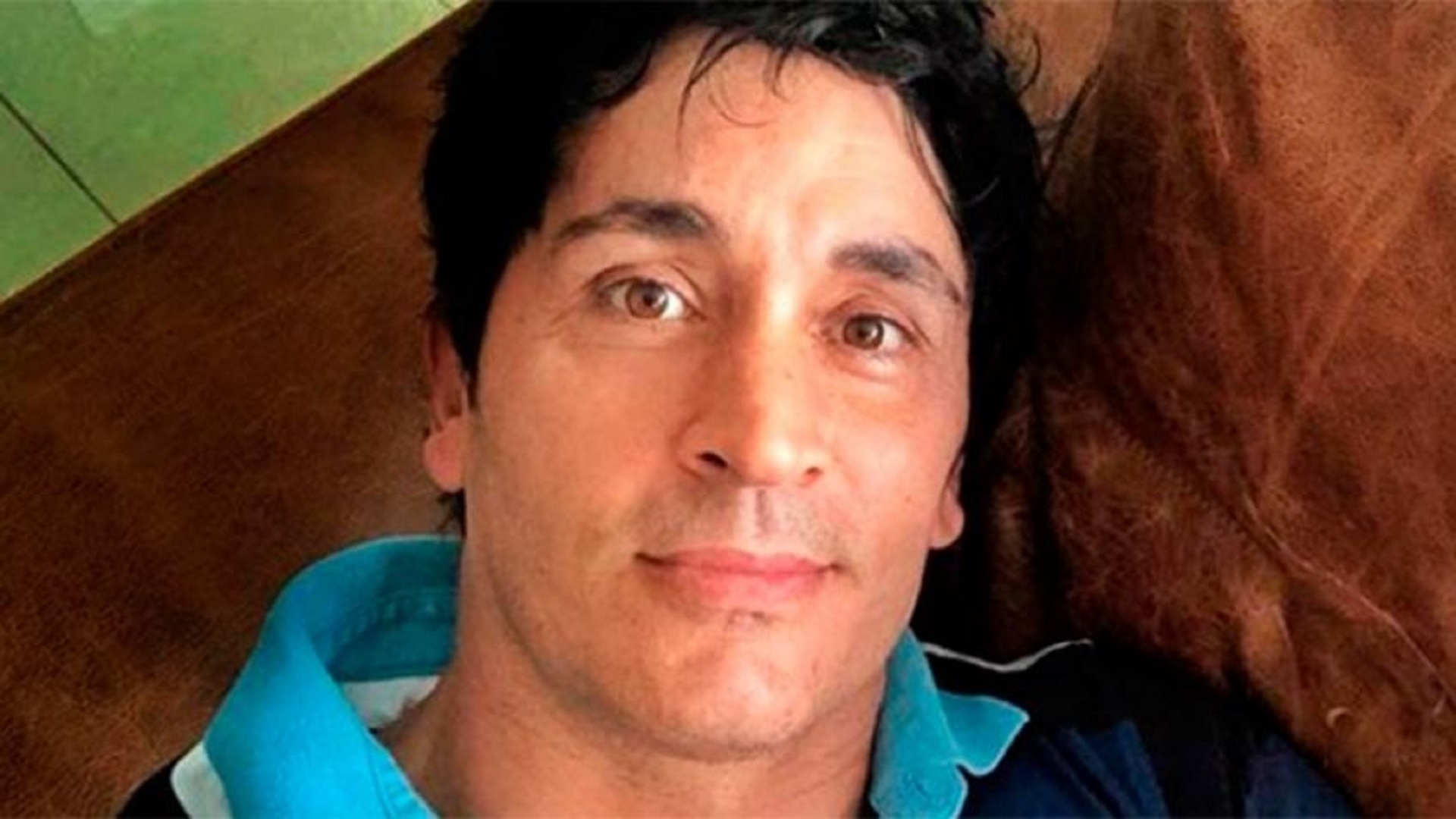 Sebastián Estevanez tras recuperarse del accidente doméstico en el que se quemó el rostro y buena parte de su cuerpo
