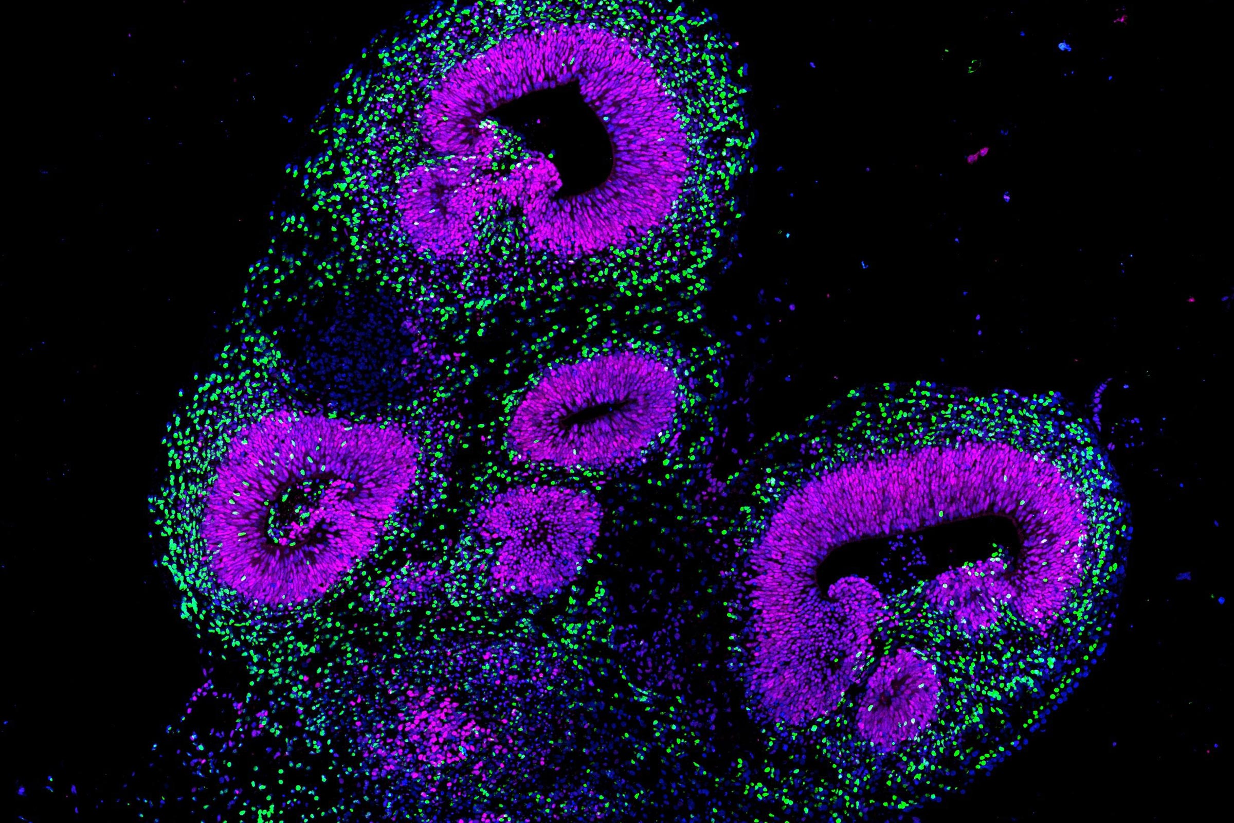 Los organoides son estructuras diminutas similares al cerebro cultivadas a partir de células madre humanas. Se usan para comprender las enfermedades humanas/ETH Zurich