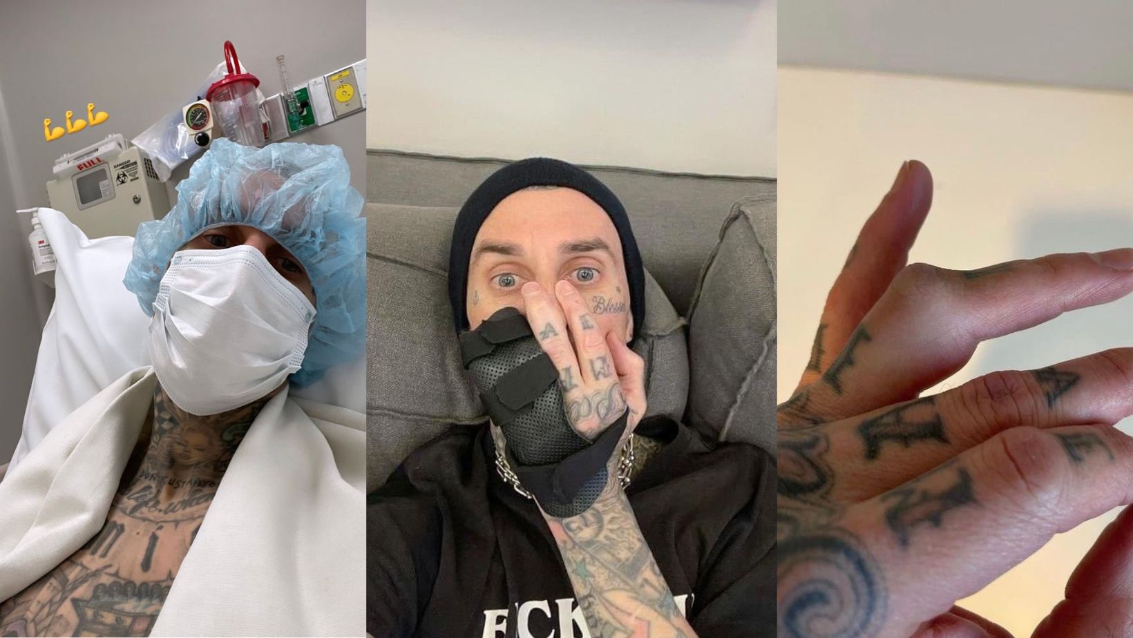 Travis Barker causó preocupación por operación en un dedo a pocas semanas  de su concierto en México - Infobae