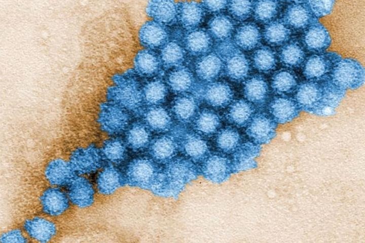 11/28/2019 Gut microbes can reduce or increase the severity of norovirus infection depending on where along the intestine the virus settles.  Norovirus particles are shown.  CDC HEALTH / CHARLES D. HUMPHREY
