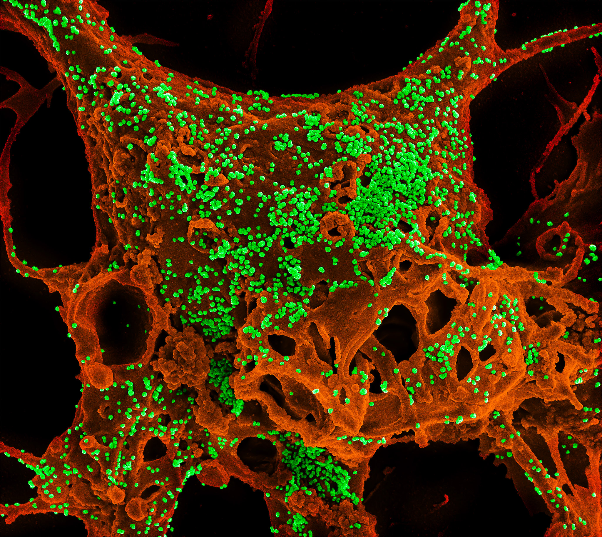 El misterioso virus MERS (síndrome respiratorio de Oriente Medio) preocupa a las autoridades sanitarias de Qatar y al plantel de Francia (NIH)