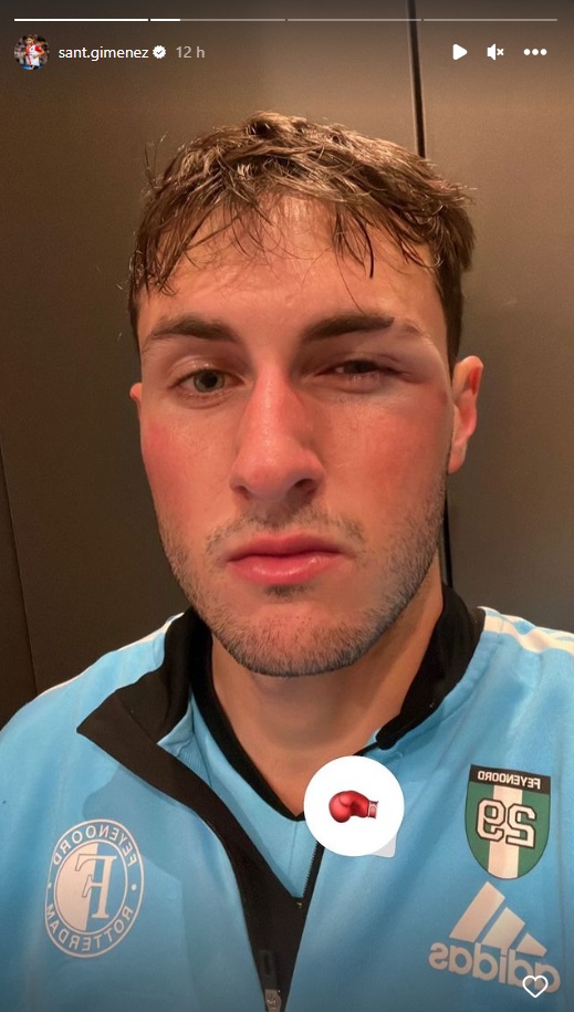 Santiago Giménez apareció con el ojo morado después de un entrenamiento con el Feyenoord (Instagram/ @sant.gimenez)
