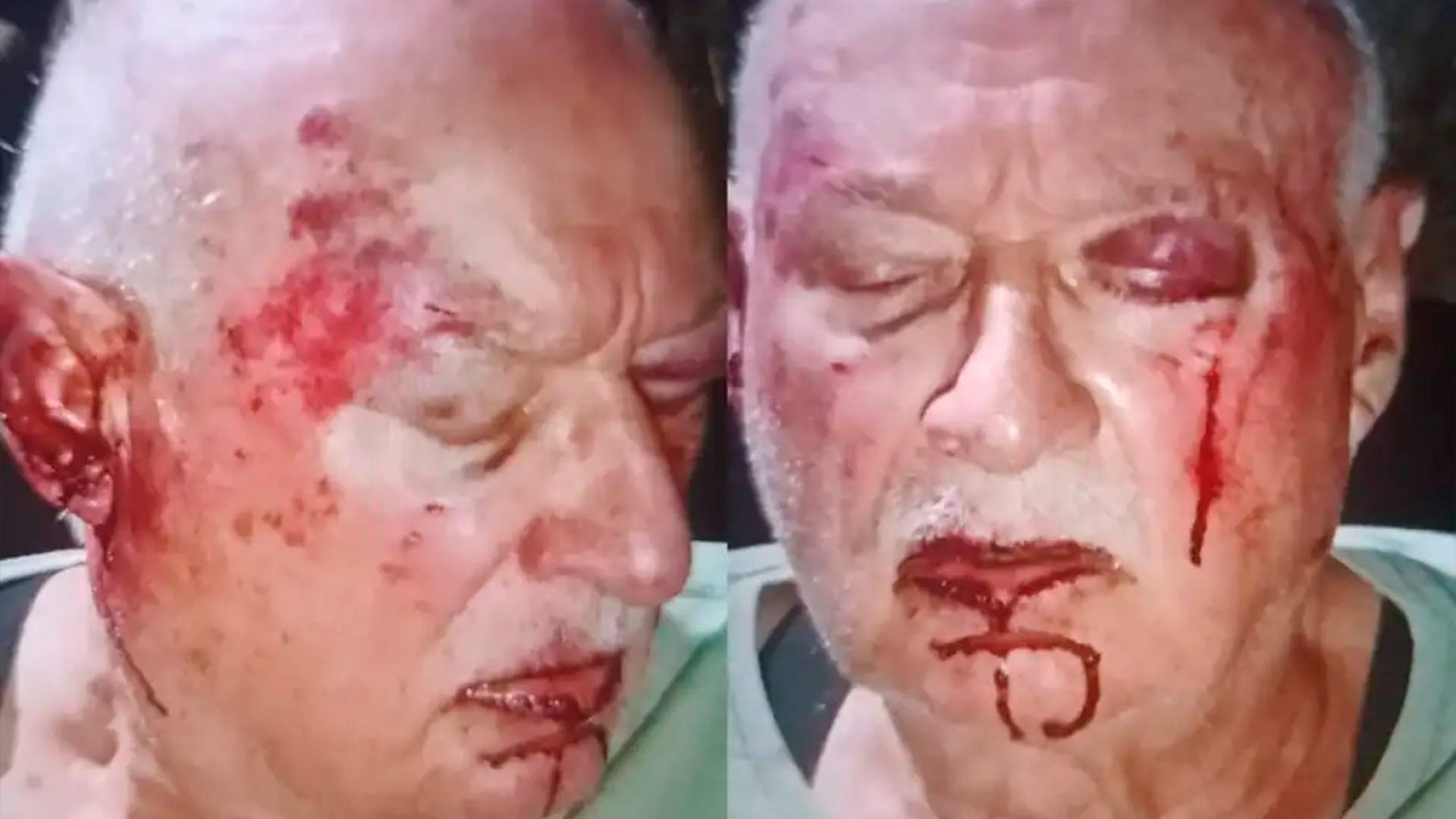 Científicos crean mini pulmones en laboratorio para agilizar la investigación de enfermedades respiratorias