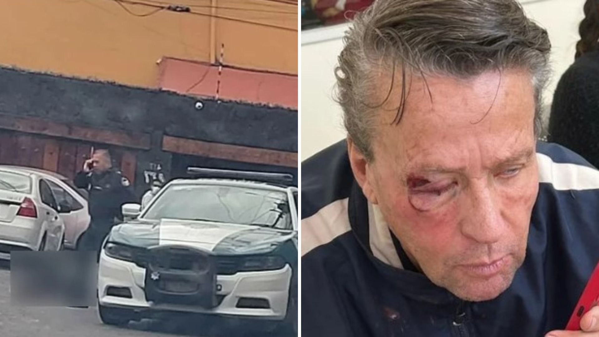 Alfredo Adame fue golpeado cuando salió de su domicilio por la movilización policiaca en la zona.
(Fotos: Instagram @adamereacciona//Especial)
