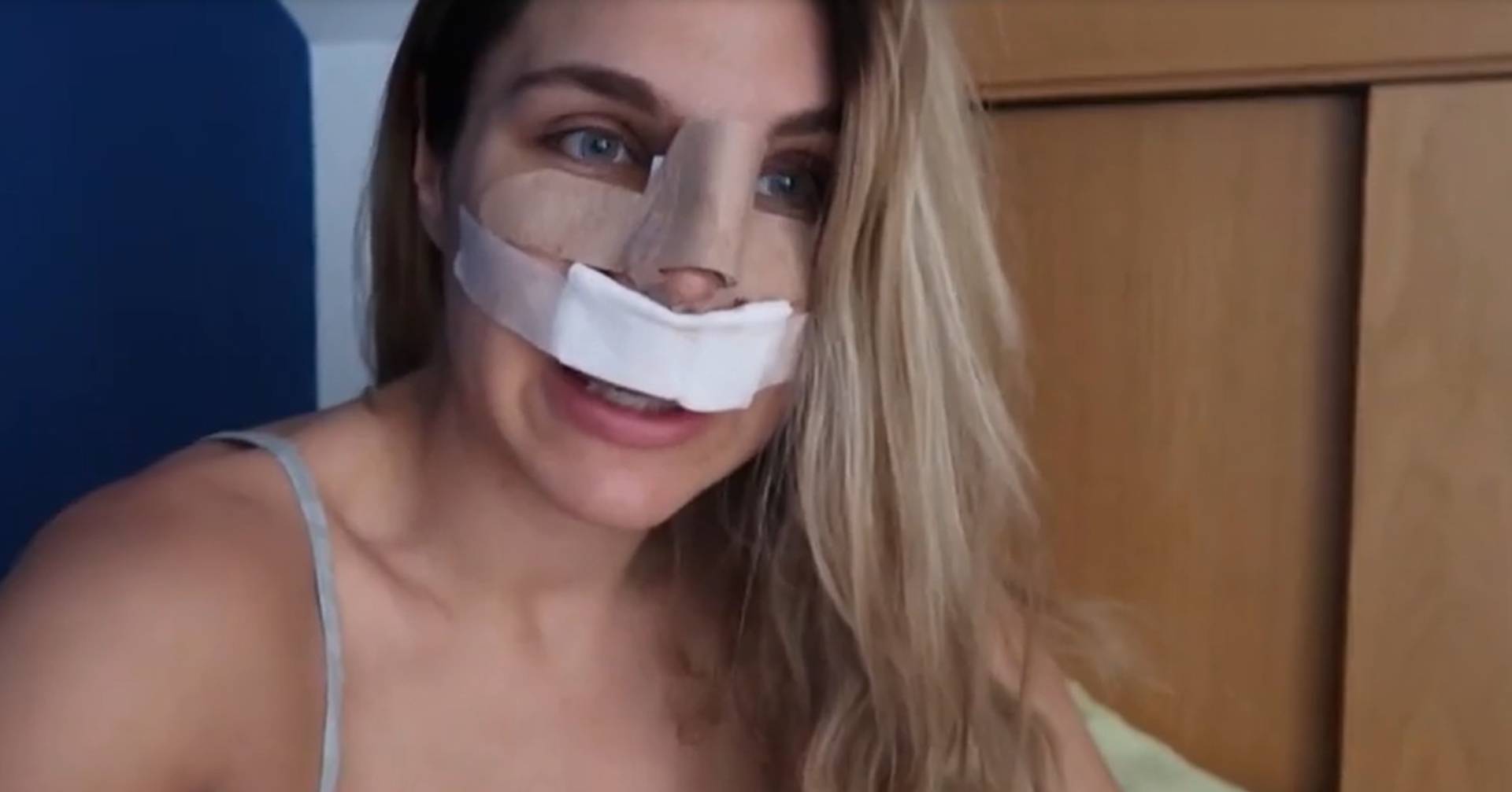 Ivana Icardi se sometió a una rinoplastía y mostró su nueva cara: “Me veo rara”    