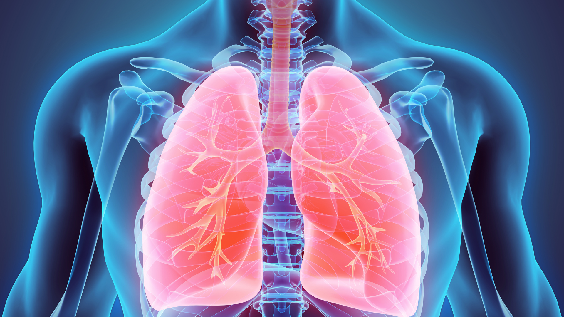 El asma es una enfermedad crónica que afecta a niños y adultos. Las vías que conducen el aire a los pulmones se estrechan debido a la inflamación y la compresión de los músculos que rodean las vías respiratorias finas/Archivo