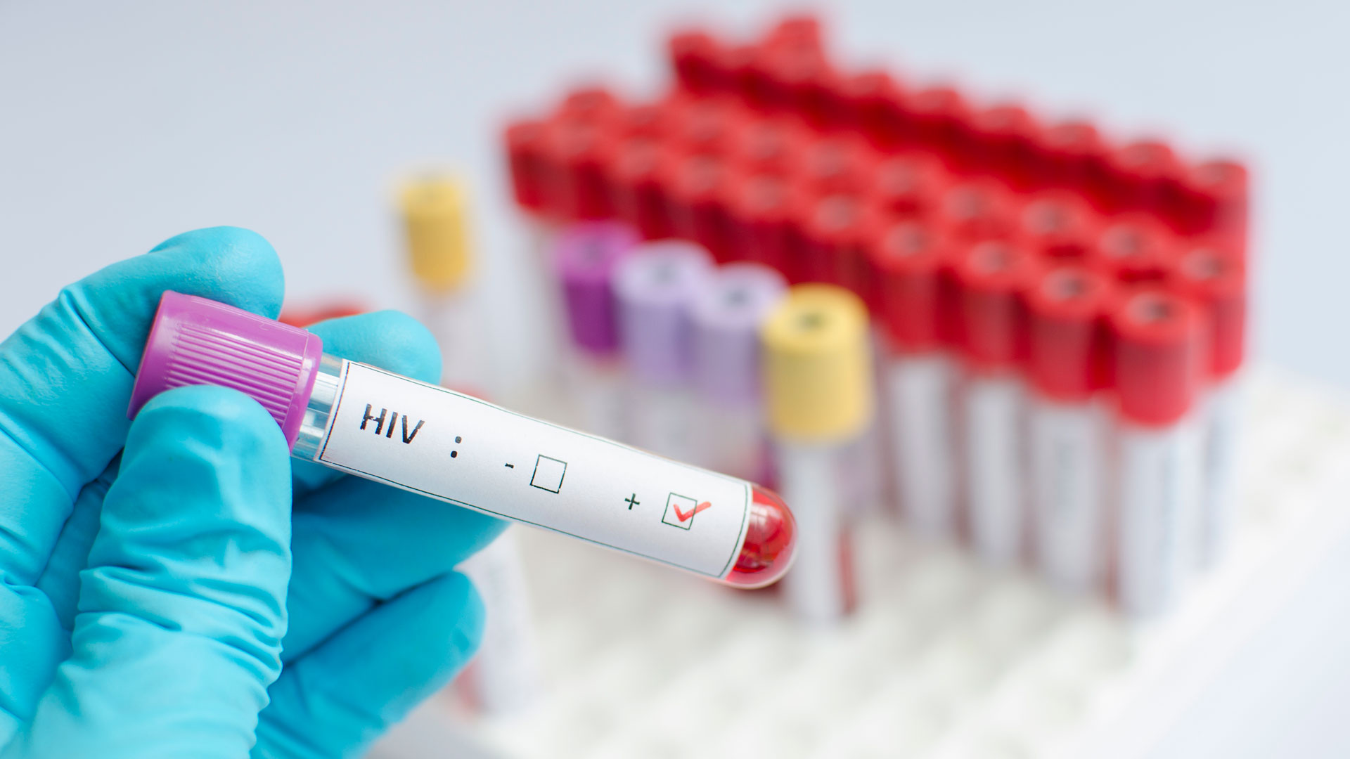Cómo es la campaña de testeos gratuitos en todo el país para detectar el VIH/Sida  