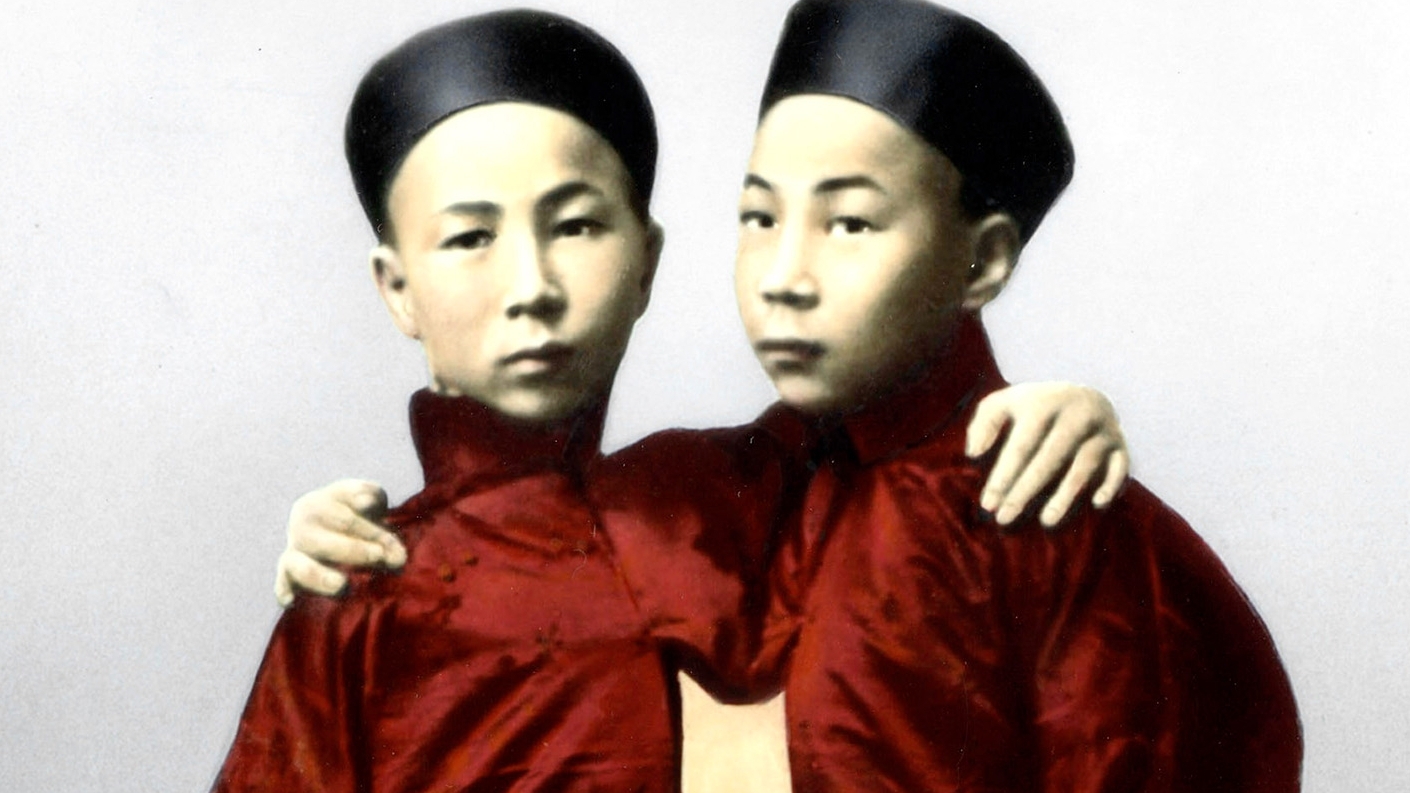 La trágica y fascinante historia de Chang y Eng, los gemelos unidos por el torso que dieron origen al adjetivo “siameses”