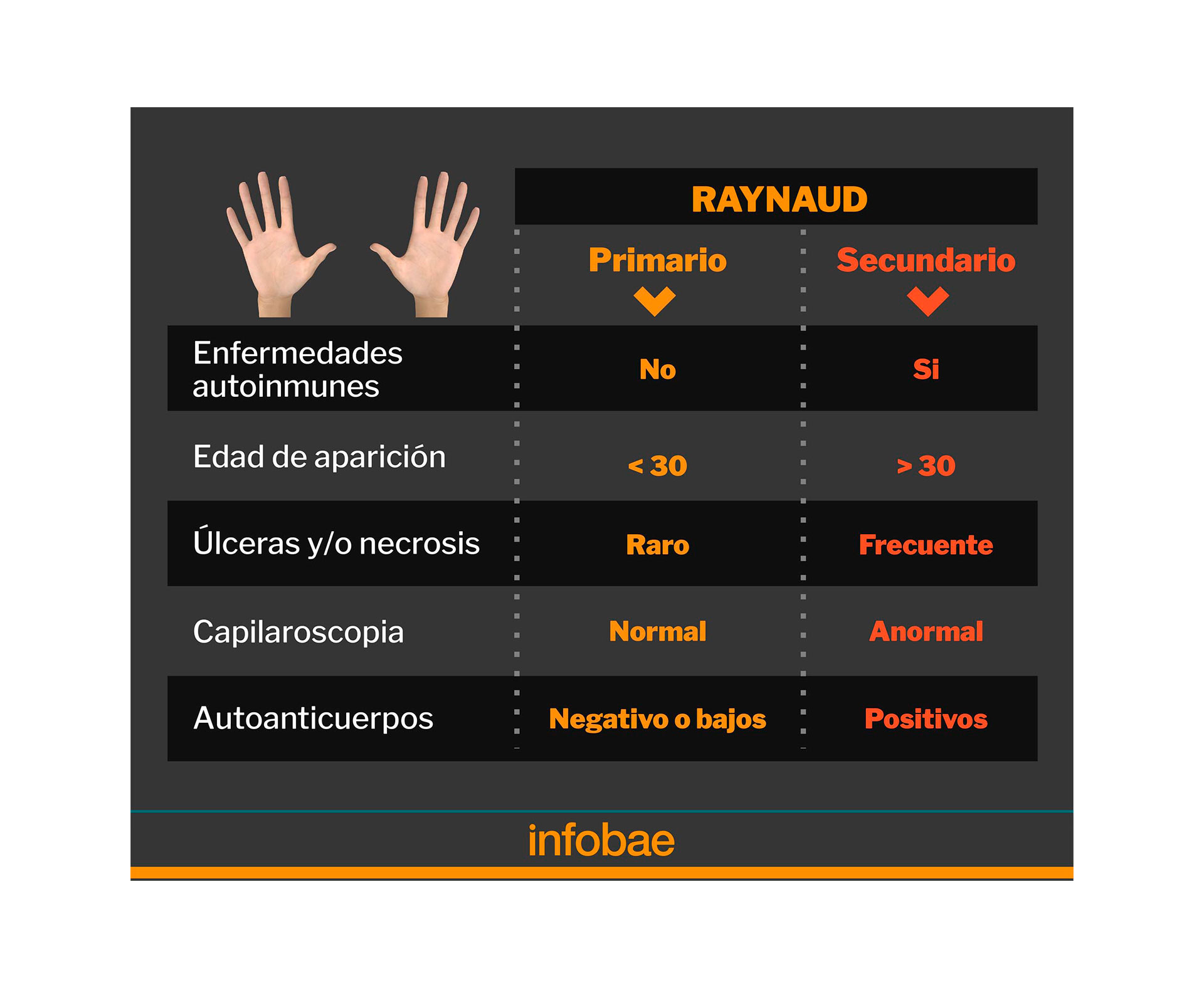Distintas clasificaciones del fenómeno de Raynaud (Infografía: Marcelo Regalado)