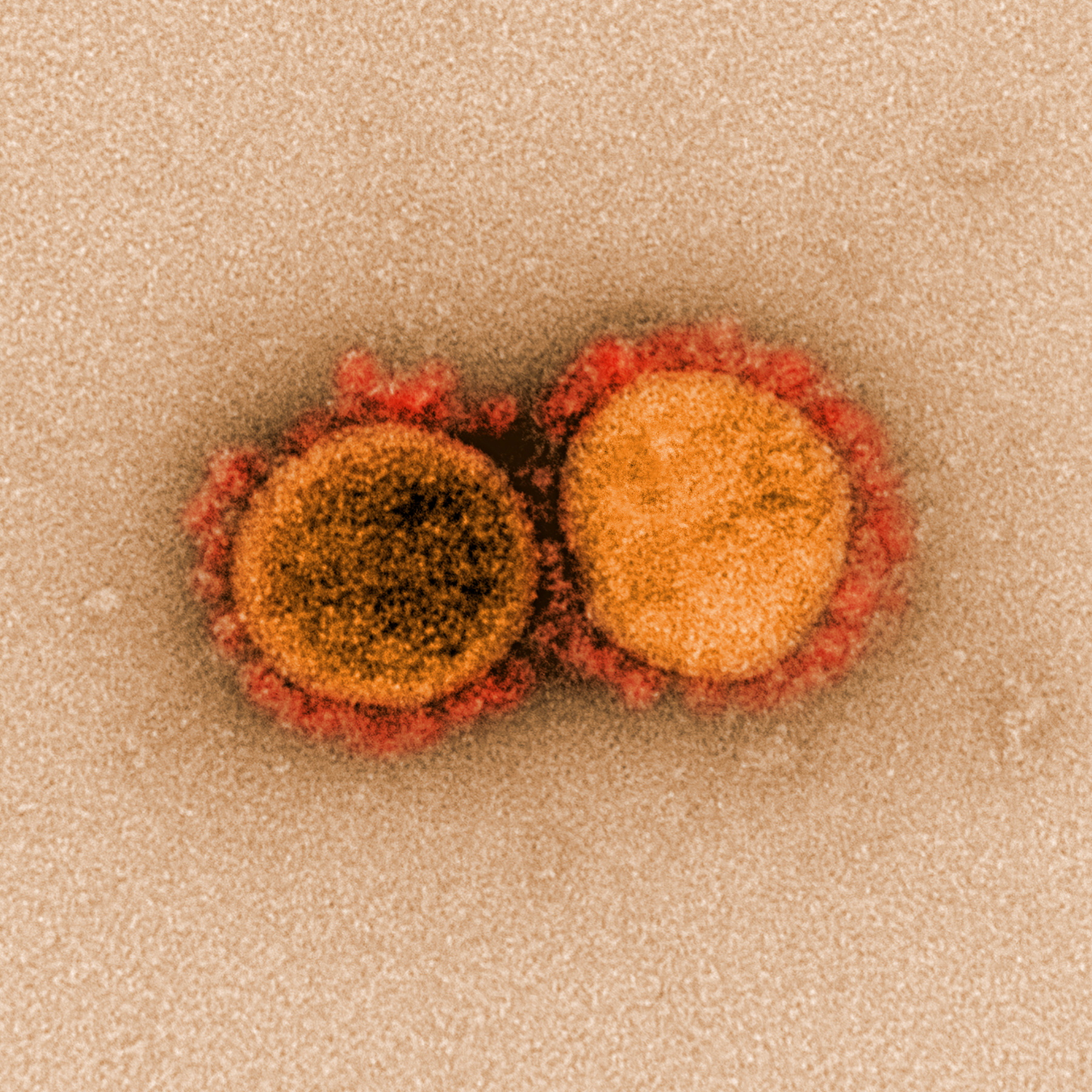 FILE PHOTO: Transmission electron micrograph of SARS-CoV-2 virus particles, also known as novel coronavirus