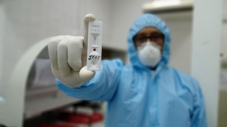 Las pruebas antígenas son caras en el Perú en comparación con las que se ofrecen en Europa. Foto: Andina