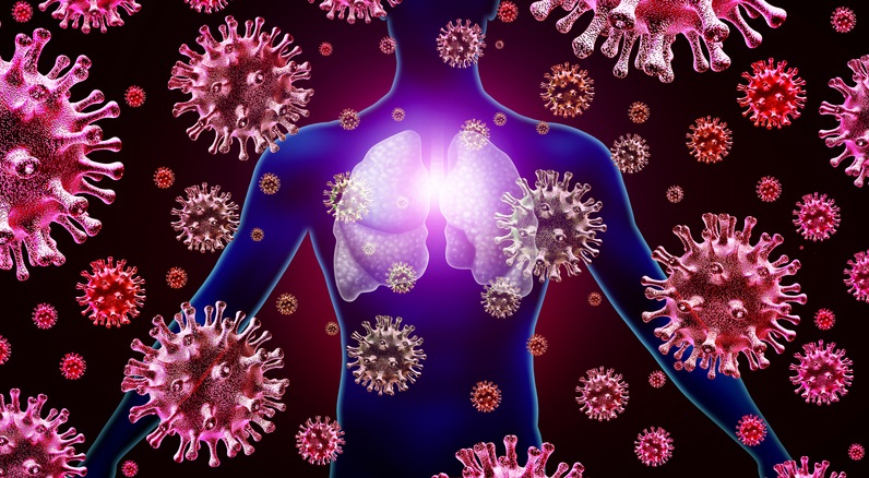 12/05/2020 Infección pulmonar

Infección pulmonar por virus respiratorios y brote de gripe y coronavirus o coronavirus como casos peligrosos de SARS como un concepto médico pandémico o epidémico con elementos de ilustración 3D.
SALUD
WILDPIXEL
