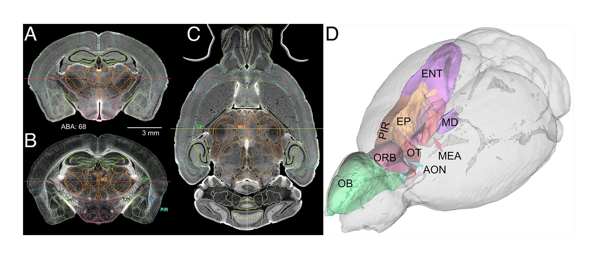La imagen muestra una representación volumétrica de cerebro completo con la microscopía de hoja de luz (G. Allan Johnson, Yuqi Tian, David G. Ashbrook y Robert W. Williams)