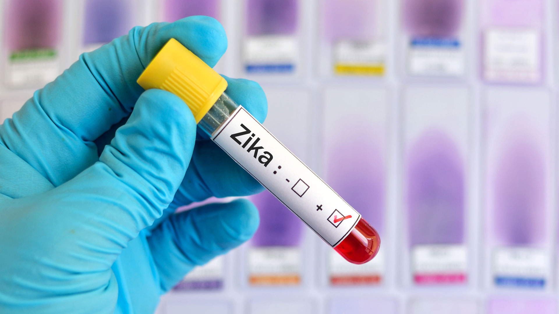 El zika afectó a muchas embarazadas en toda la región y provocó malformaciones en los niños / 
