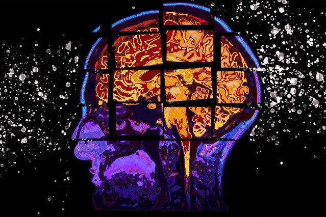 La demencia es un término general que se utiliza para describir una variedad de trastornos neurológicos progresivos que afectan la memoria, el pensamiento y el comportamiento (Europa Press)