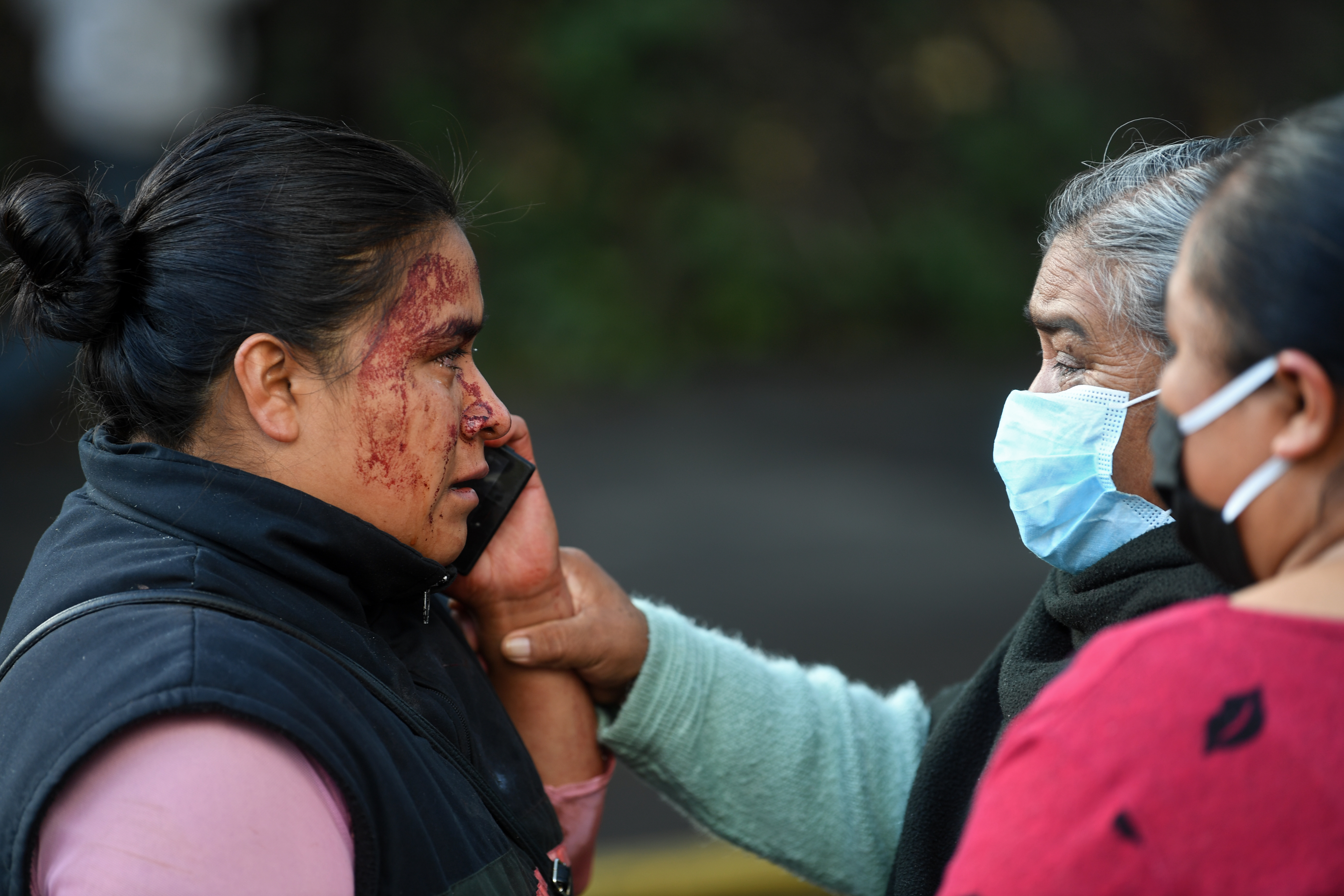 Un pariente de un transeúnte que fue asesinado en el ataque al Secretario de Seguridad Pública de la Ciudad de México, Omar García Harfuch, habla por teléfono en la escena del crimen en la Ciudad de México, el 26 de junio de 2020. (Foto: PEDRO PARDO / AFP)